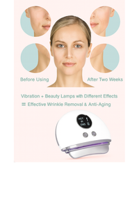 RadiantLift 4-in-1 Face Massager™